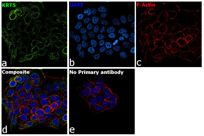 Cytokeratin 5 Antibody in Immunocytochemistry (ICC/IF)