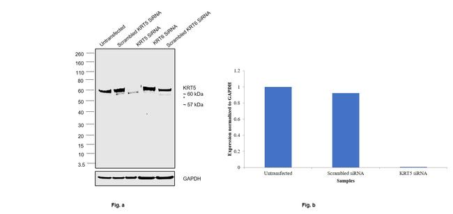 Cytokeratin 5 Antibody in Western Blot (WB)