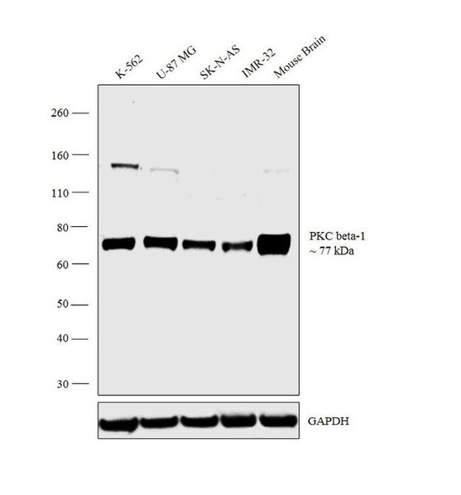 PKC beta Antibody in Western Blot (WB)