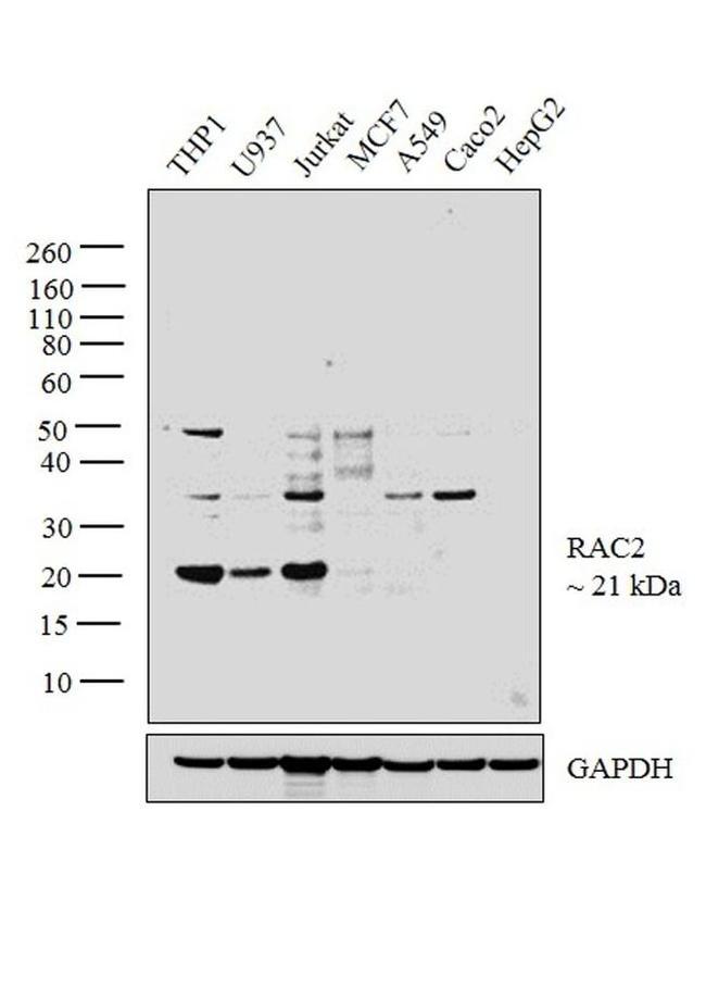 RAC2 Antibody in Western Blot (WB)