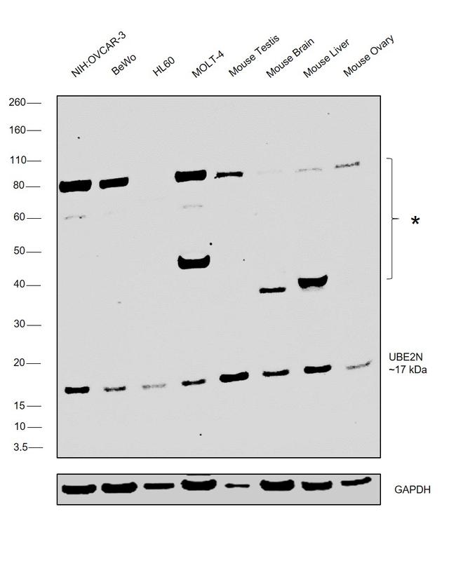 UBC13 Antibody in Western Blot (WB)