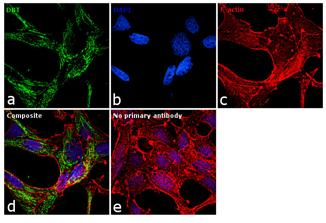 DBT Antibody in Immunocytochemistry (ICC/IF)