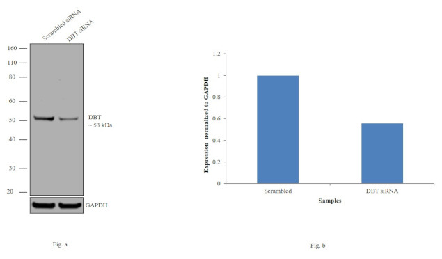 DBT Antibody