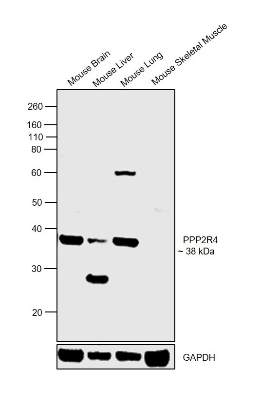 PPP2R4 Antibody