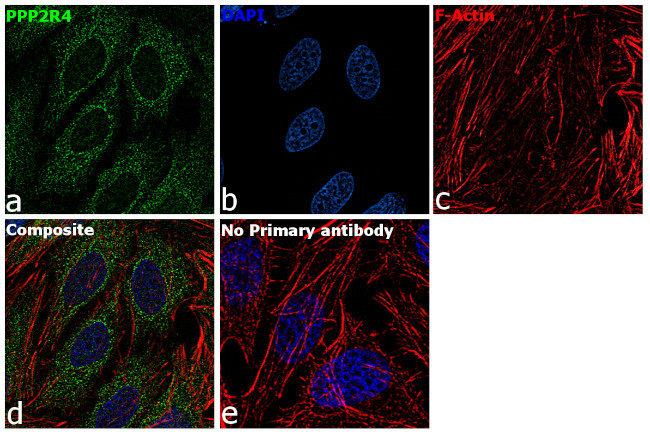 PPP2R4 Antibody in Immunocytochemistry (ICC/IF)