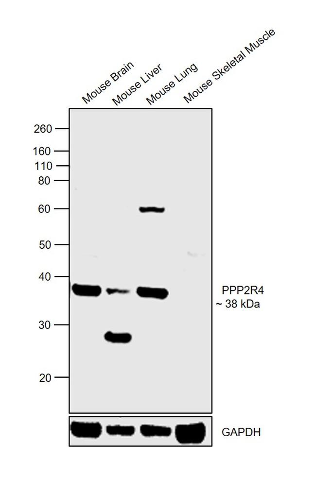 PPP2R4 Antibody in Western Blot (WB)