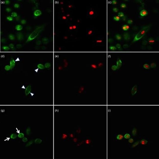 SSB Antibody in Immunocytochemistry (ICC/IF)