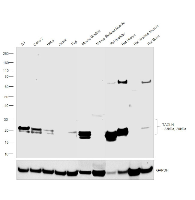 TAGLN Antibody