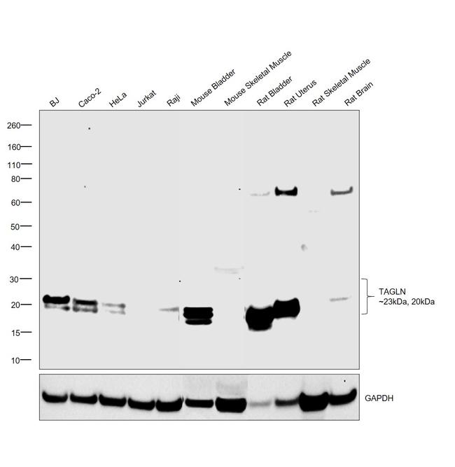 TAGLN Antibody in Western Blot (WB)