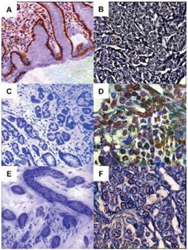 14-3-3 epsilon Antibody in Immunohistochemistry (IHC)