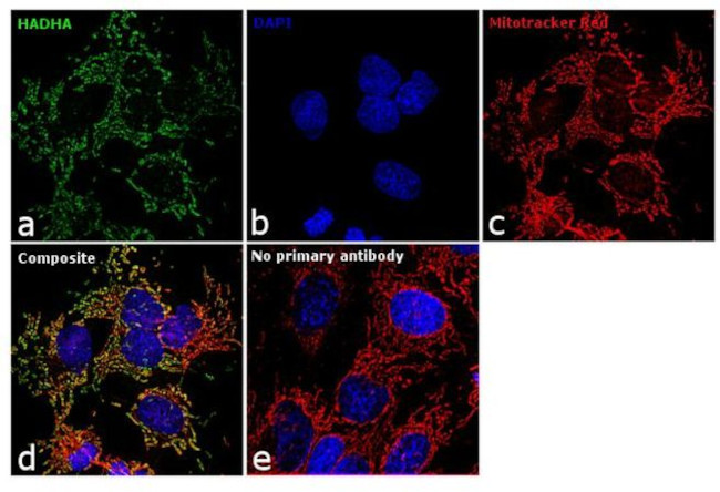 HADHA Antibody in Immunocytochemistry (ICC/IF)