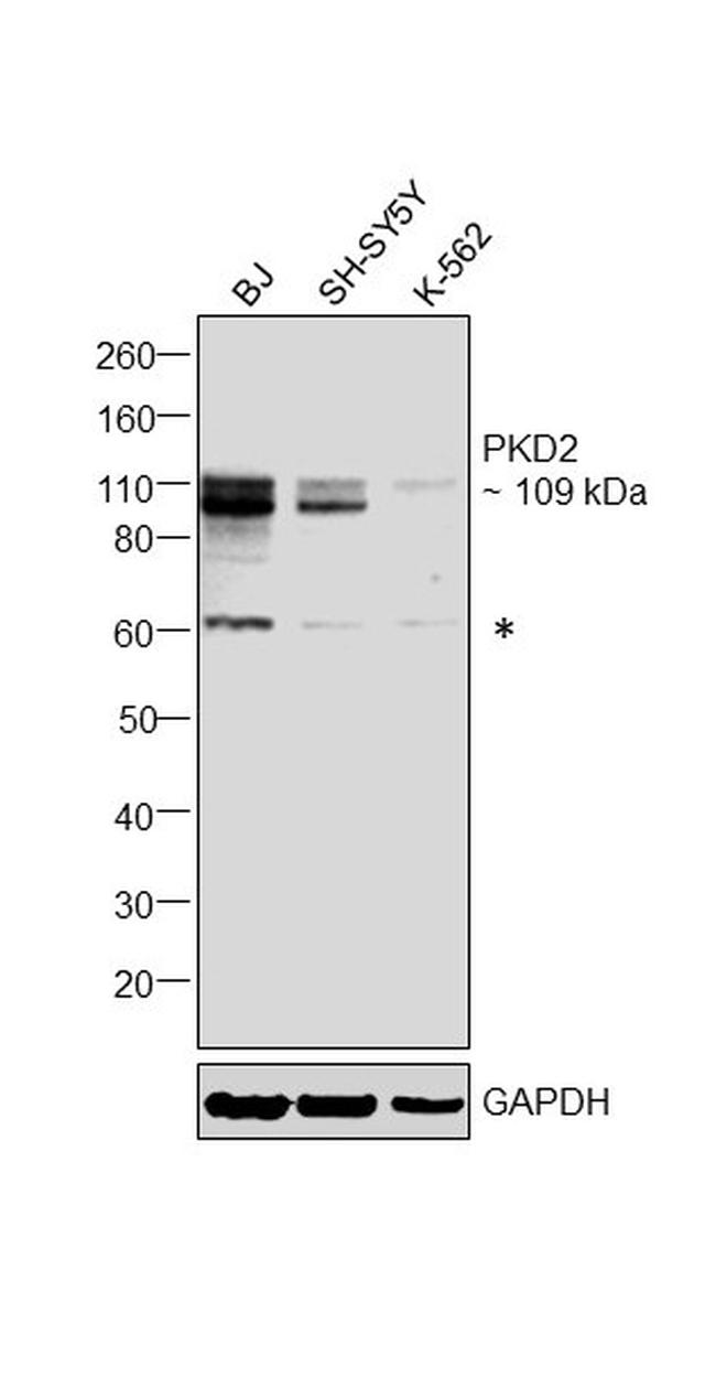 PKD2 Antibody in Western Blot (WB)