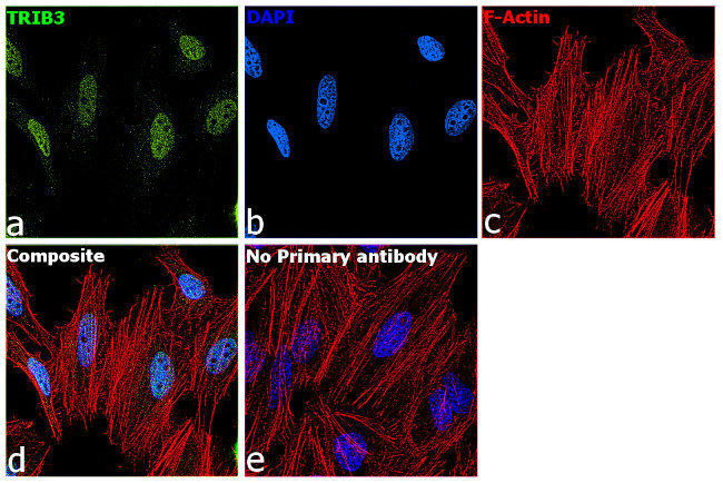 TRIB3 Antibody in Immunocytochemistry (ICC/IF)