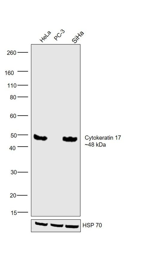 Cytokeratin 17 Antibody