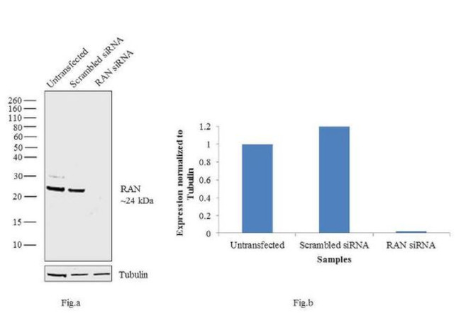 RAN Antibody