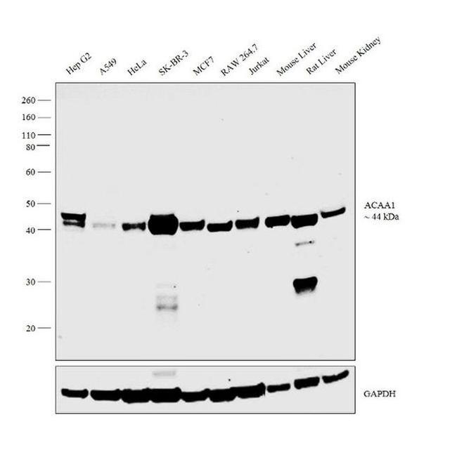 ACAA1 Antibody in Western Blot (WB)