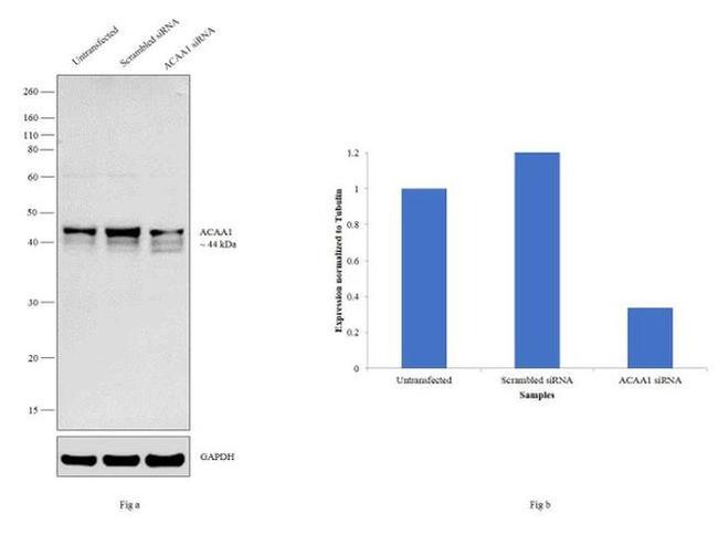 ACAA1 Antibody in Western Blot (WB)