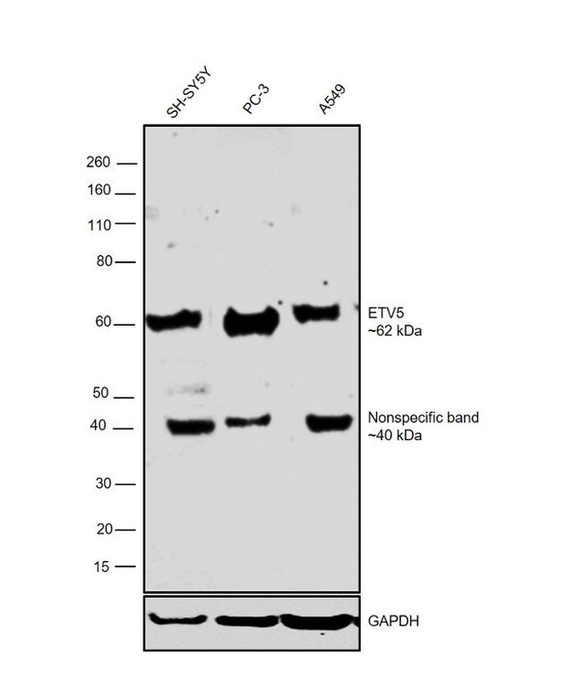 ETV5 Antibody in Western Blot (WB)