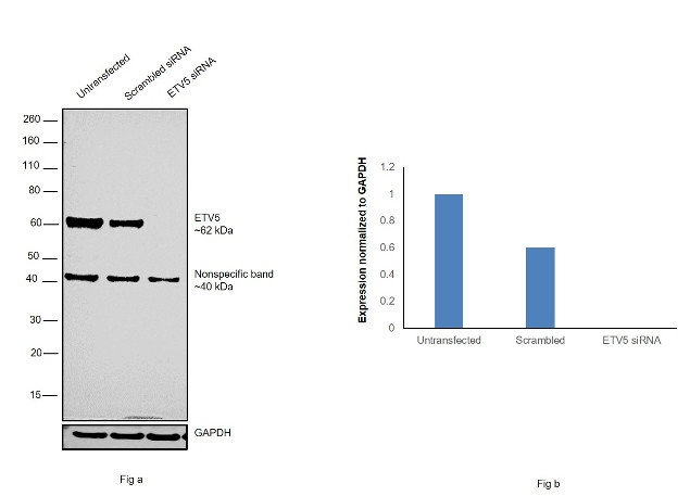 ETV5 Antibody