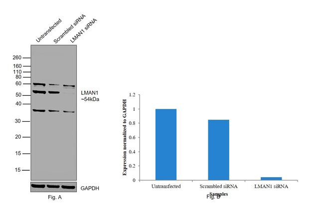 LMAN1 Antibody in Western Blot (WB)