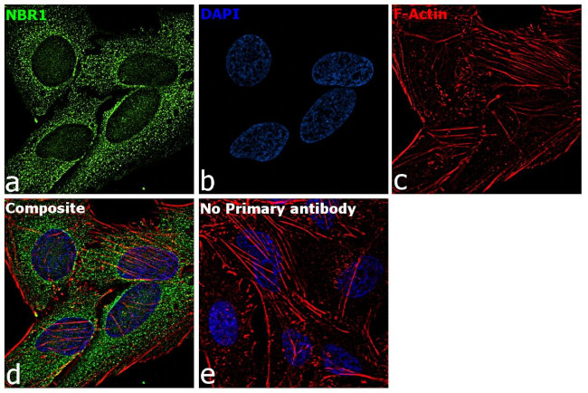 NBR1 Antibody in Immunocytochemistry (ICC/IF)