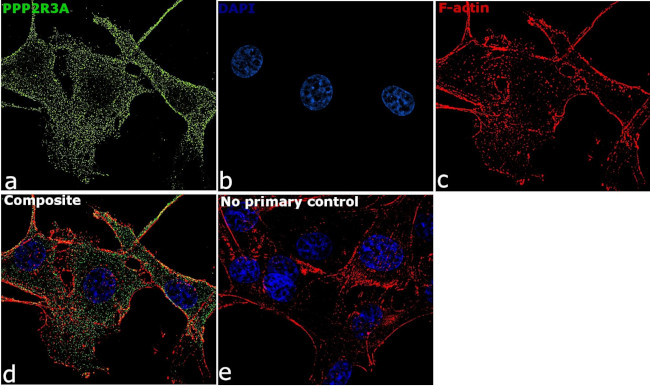 PPP2R3A Antibody in Immunocytochemistry (ICC/IF)