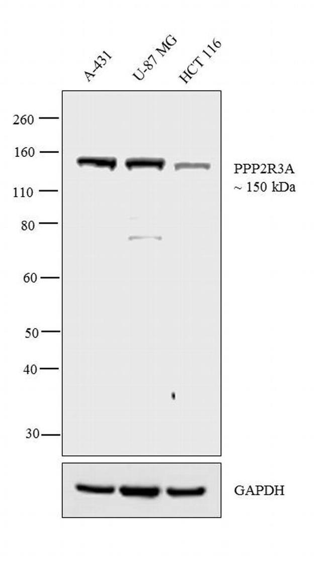 PPP2R3A Antibody in Western Blot (WB)