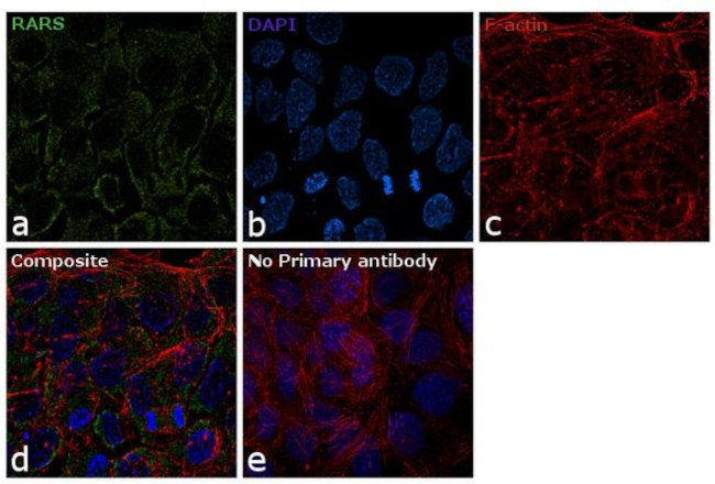 RARS Antibody in Immunocytochemistry (ICC/IF)