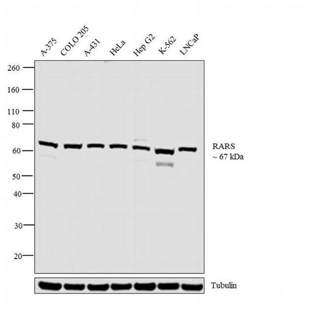 RARS Antibody in Western Blot (WB)