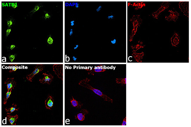 SATB1 Antibody in Immunocytochemistry (ICC/IF)