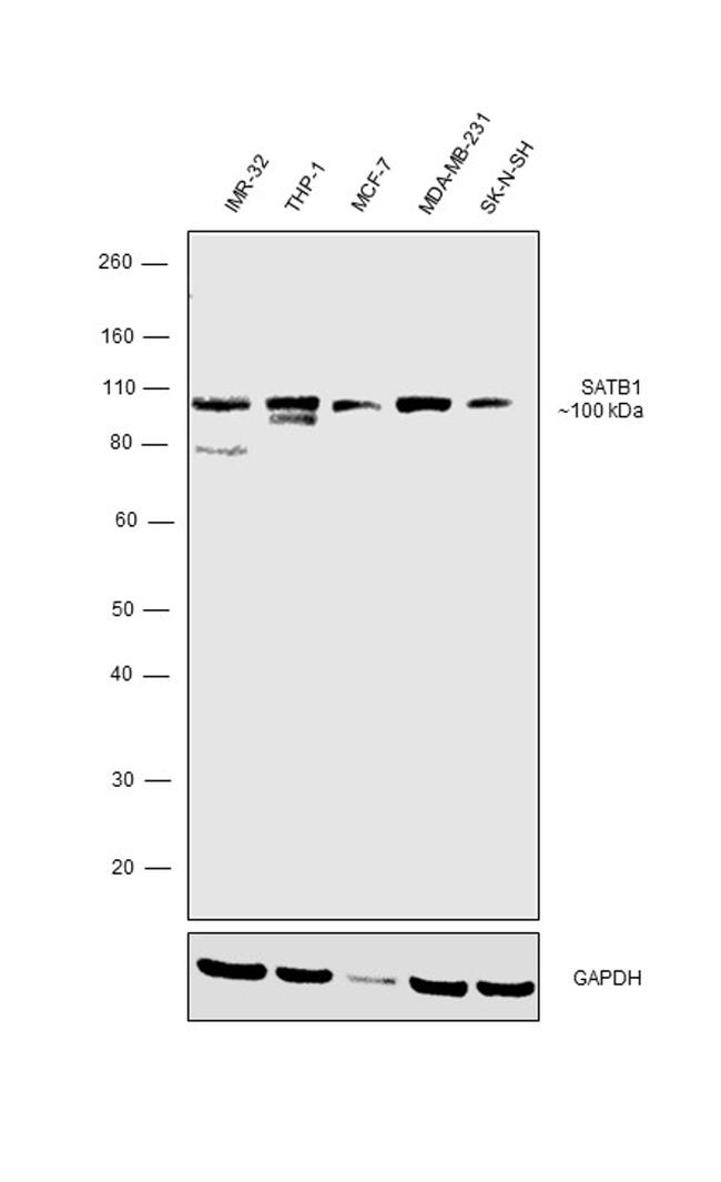 SATB1 Antibody in Western Blot (WB)