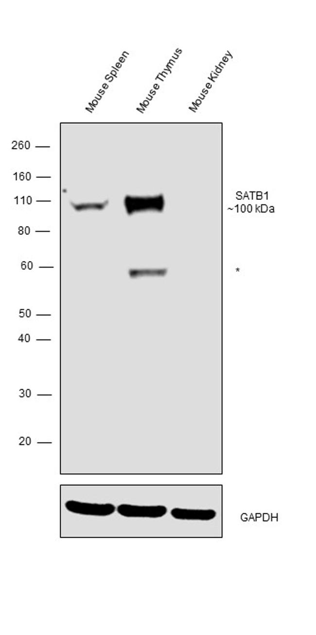 SATB1 Antibody in Western Blot (WB)