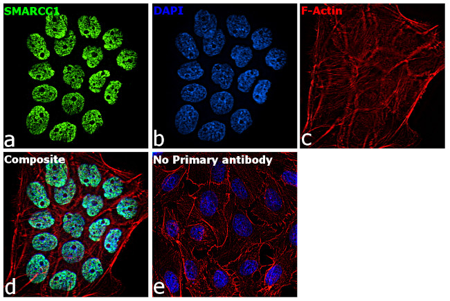 SMARCC1 Antibody in Immunocytochemistry (ICC/IF)