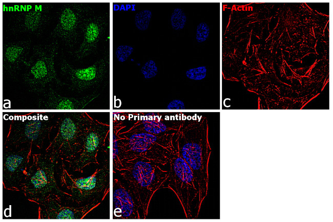 hnRNP M Antibody in Immunocytochemistry (ICC/IF)