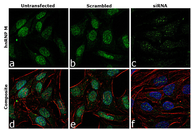 hnRNP M Antibody in Immunocytochemistry (ICC/IF)