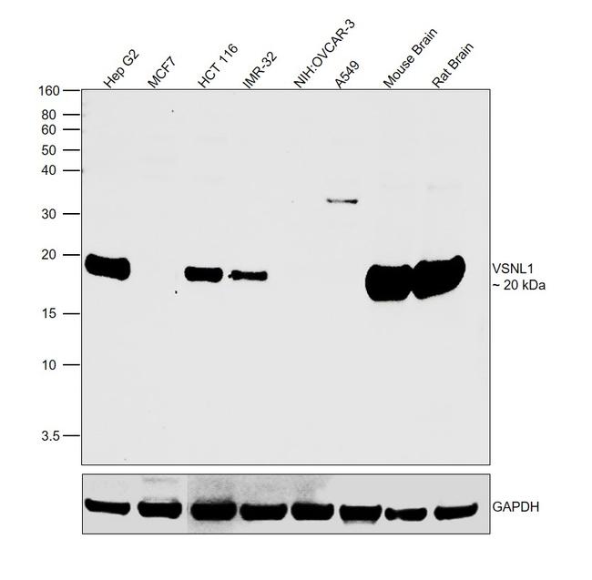 VSNL1 Antibody in Western Blot (WB)