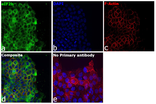 EIF2B4 Antibody in Immunocytochemistry (ICC/IF)