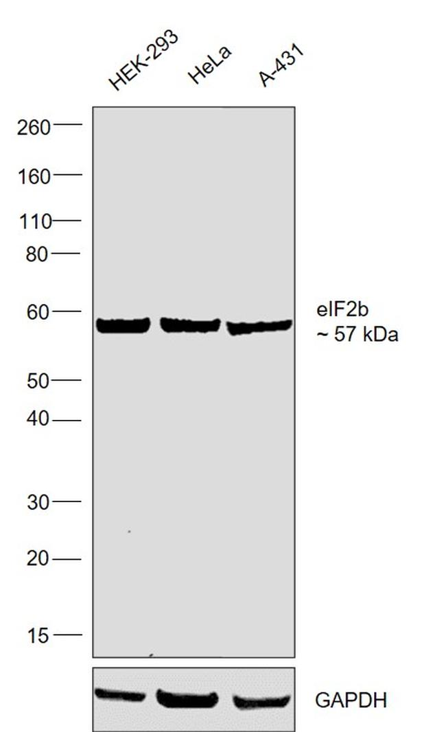 EIF2B4 Antibody in Western Blot (WB)