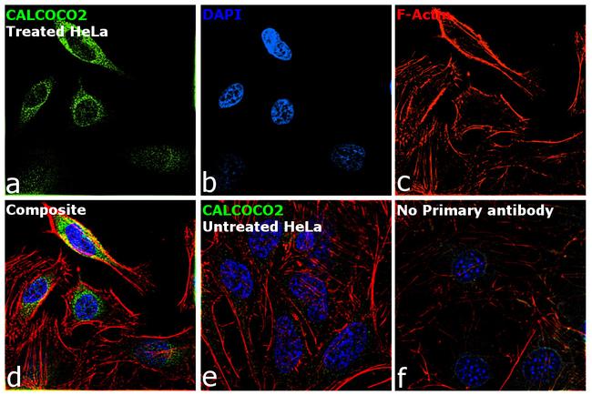 CALCOCO2 Antibody