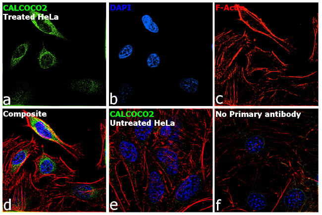 CALCOCO2 Antibody in Immunocytochemistry (ICC/IF)