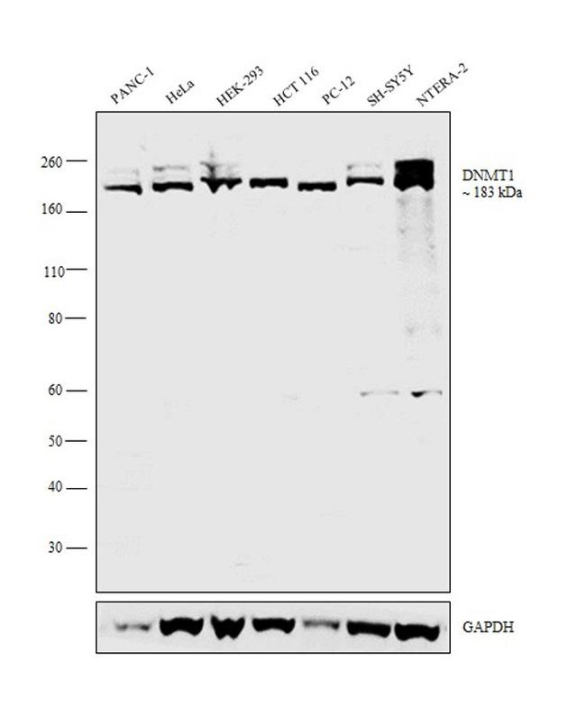 DNMT1 Antibody in Western Blot (WB)