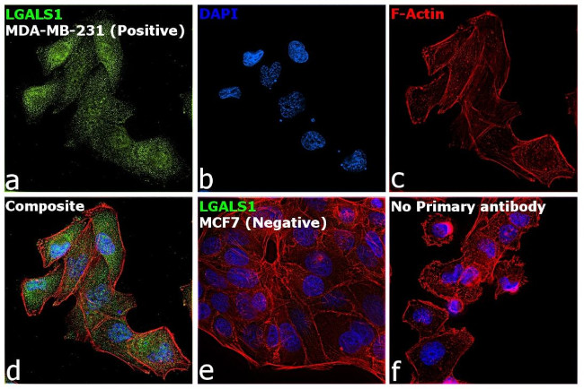 Galectin 1 Antibody