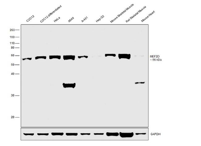 MEF2D Antibody in Western Blot (WB)