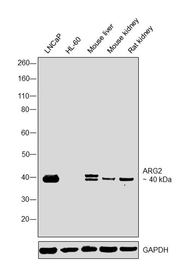 Arginase 2 Antibody in Western Blot (WB)