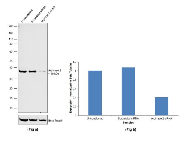 Arginase 2 Antibody in Western Blot (WB)