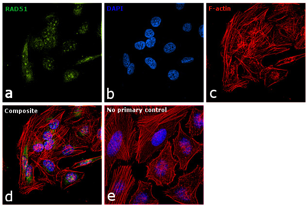 RAD51 Antibody in Immunocytochemistry (ICC/IF)