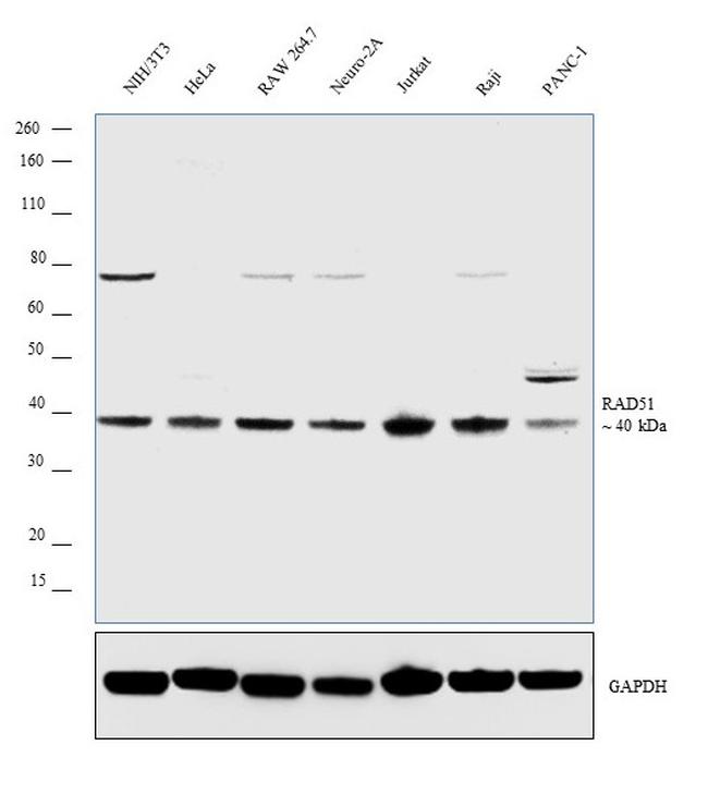 RAD51 Antibody in Western Blot (WB)