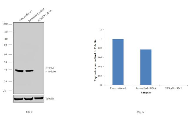 STRAP Antibody in Western Blot (WB)