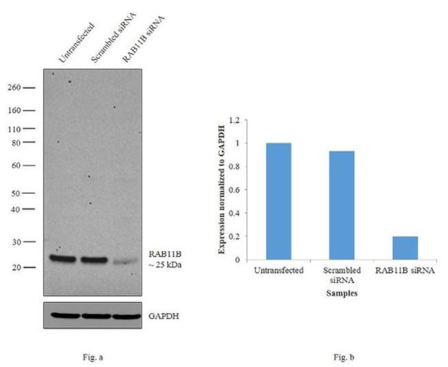 RAB11B Antibody