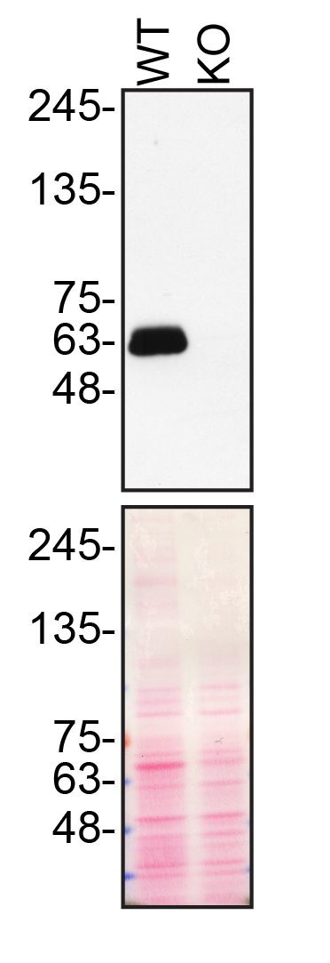 SMOC1 Antibody in Western Blot (WB)